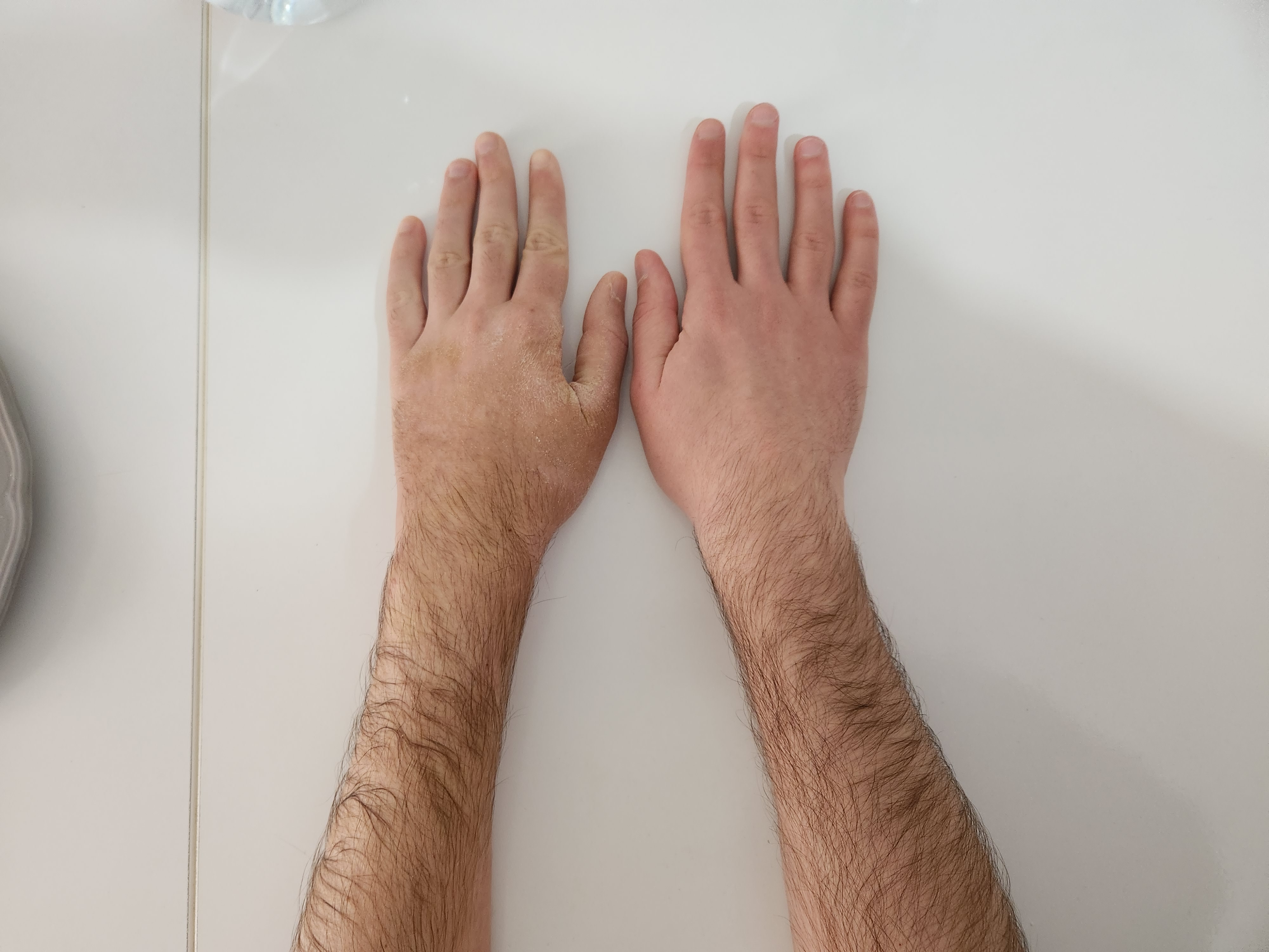 Left hand is darker and dirtier than the right hand