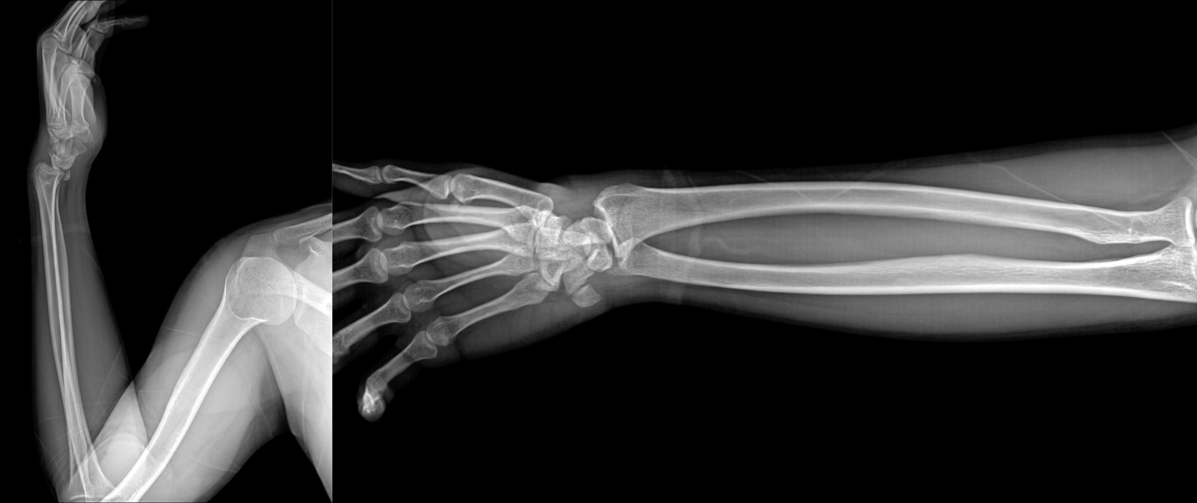 X-ray images