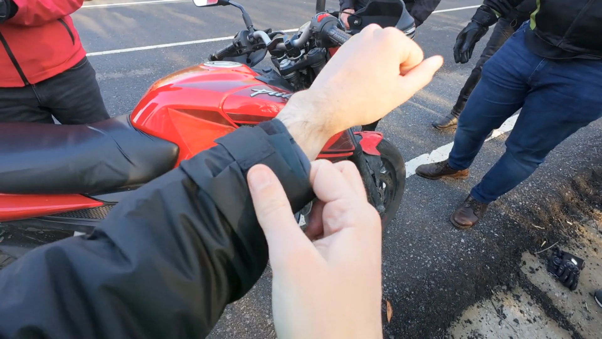 First moment I saw my broken wrist