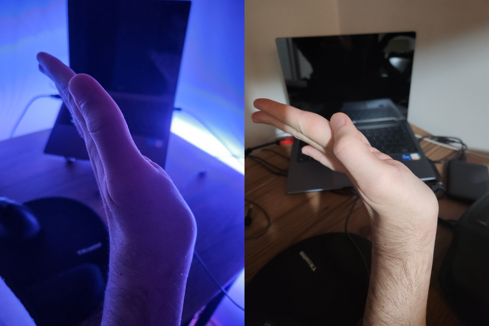 Maximum angle that I can do with my hand is increased in 8 days